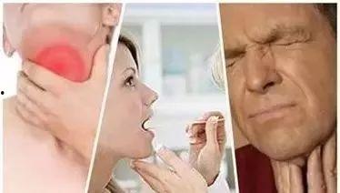 吃瓜喉咙疼怎么办